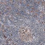 MKL1 Monoclonal Antibody (CL4281)