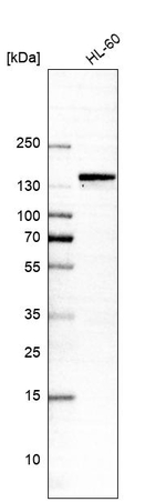 MKL1 Antibody in Western Blot (WB)