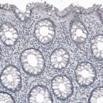 SOX21 Antibody in Immunohistochemistry (Paraffin) (IHC (P))