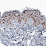 SOX21 Antibody in Immunohistochemistry (Paraffin) (IHC (P))