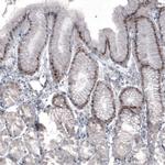 SOX21 Antibody in Immunohistochemistry (Paraffin) (IHC (P))