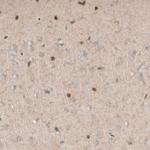 SOX21 Antibody in Immunohistochemistry (Paraffin) (IHC (P))