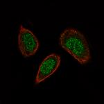 SOX21 Antibody in Immunocytochemistry (ICC/IF)