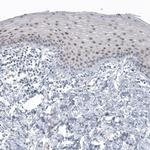 SOX21 Antibody in Immunohistochemistry (Paraffin) (IHC (P))