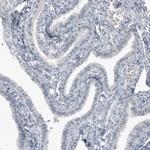 SOX21 Antibody in Immunohistochemistry (Paraffin) (IHC (P))