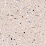 SOX21 Antibody in Immunohistochemistry (Paraffin) (IHC (P))