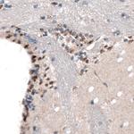 SOX21 Antibody in Immunohistochemistry (Paraffin) (IHC (P))