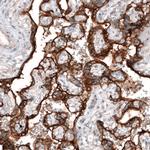 CLIP1 Antibody in Immunohistochemistry (Paraffin) (IHC (P))