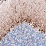 CLIP1 Antibody in Immunohistochemistry (Paraffin) (IHC (P))