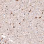 CDKL5 Monoclonal Antibody (CL4881)