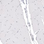 CDKL5 Antibody in Immunohistochemistry (Paraffin) (IHC (P))