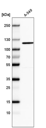 CDKL5 Antibody in Western Blot (WB)