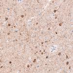 CDKL5 Antibody in Immunohistochemistry (Paraffin) (IHC (P))