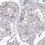 CDKL5 Antibody in Immunohistochemistry (Paraffin) (IHC (P))