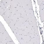 CDKL5 Monoclonal Antibody (CL4888)