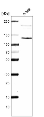 CDKL5 Antibody in Western Blot (WB)
