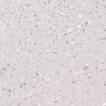 PRAME Antibody in Immunohistochemistry (Paraffin) (IHC (P))