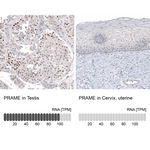 PRAME Antibody in Immunohistochemistry (Paraffin) (IHC (P))