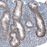PRAME Antibody in Immunohistochemistry (Paraffin) (IHC (P))