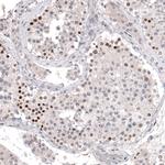 PRAME Antibody in Immunohistochemistry (Paraffin) (IHC (P))