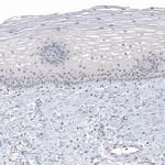PRAME Antibody in Immunohistochemistry (Paraffin) (IHC (P))