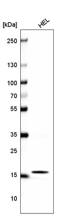 Histone H2B Antibody in Western Blot (WB)