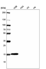 Histone H2B Antibody in Western Blot (WB)
