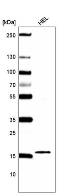 Histone H2B Antibody in Western Blot (WB)