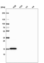Histone H2B Antibody in Western Blot (WB)