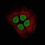 Histone Macro-H2A.1 Monoclonal Antibody (CL5245)