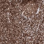 Histone Macro-H2A.1 Antibody in Immunohistochemistry (Paraffin) (IHC (P))