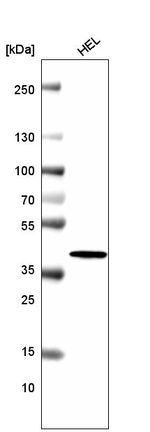 Histone Macro-H2A.1 Antibody in Western Blot (WB)