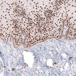 CUX1 Antibody in Immunohistochemistry (Paraffin) (IHC (P))