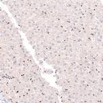 CUX1 Antibody in Immunohistochemistry (Paraffin) (IHC (P))