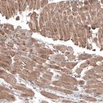 LAPTM4B Antibody in Immunohistochemistry (Paraffin) (IHC (P))
