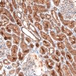 LAPTM4B Antibody in Immunohistochemistry (Paraffin) (IHC (P))