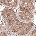 LAPTM4B Antibody in Immunohistochemistry (Paraffin) (IHC (P))
