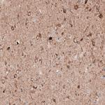 LAPTM4B Antibody in Immunohistochemistry (Paraffin) (IHC (P))