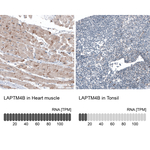 LAPTM4B Antibody in Immunohistochemistry (Paraffin) (IHC (P))