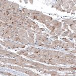 LAPTM4B Antibody in Immunohistochemistry (Paraffin) (IHC (P))