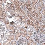 LAPTM4B Antibody in Immunohistochemistry (Paraffin) (IHC (P))