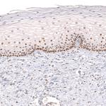 FOXP2 Antibody in Immunohistochemistry (Paraffin) (IHC (P))
