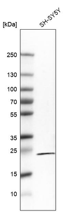 RGS5 Monoclonal Antibody (CL5568)