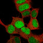 SOX4 Monoclonal Antibody (CL5634)