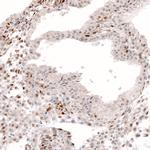 SOX4 Antibody in Immunohistochemistry (Paraffin) (IHC (P))