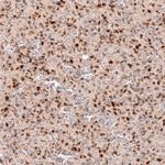 SOX4 Antibody in Immunohistochemistry (Paraffin) (IHC (P))