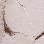 SOX4 Antibody in Immunohistochemistry (Paraffin) (IHC (P))