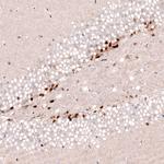 SOX4 Antibody in Immunohistochemistry (Paraffin) (IHC (P))