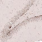 SOX4 Antibody in Immunohistochemistry (Paraffin) (IHC (P))