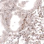 SOX4 Antibody in Immunohistochemistry (Paraffin) (IHC (P))